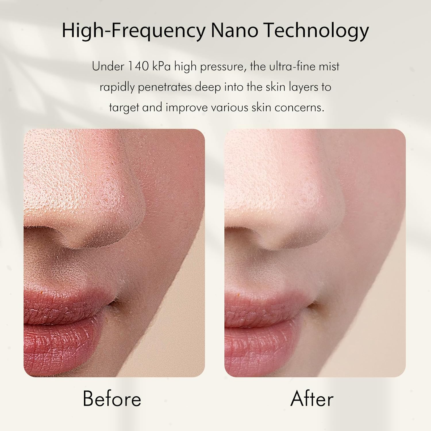 Нано-ионный распылитель холодн – обзор и цена Facial Steamer Nano